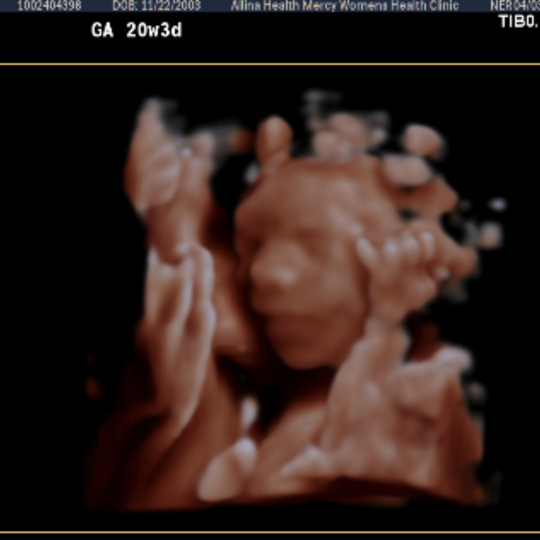 Photo shared by Mya for their Babylist baby registry.