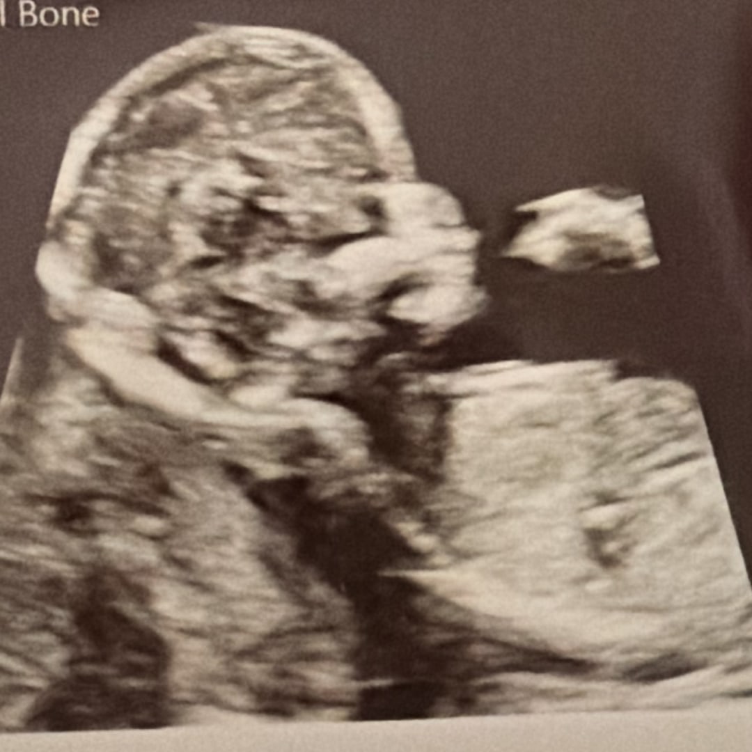 Photo shared by Rise for their Babylist baby registry.