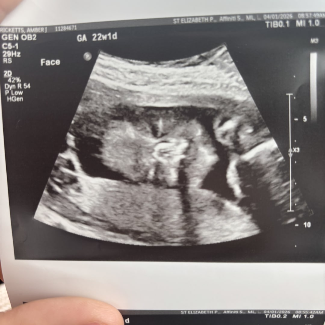 Photo shared by Amber for their Babylist baby registry.