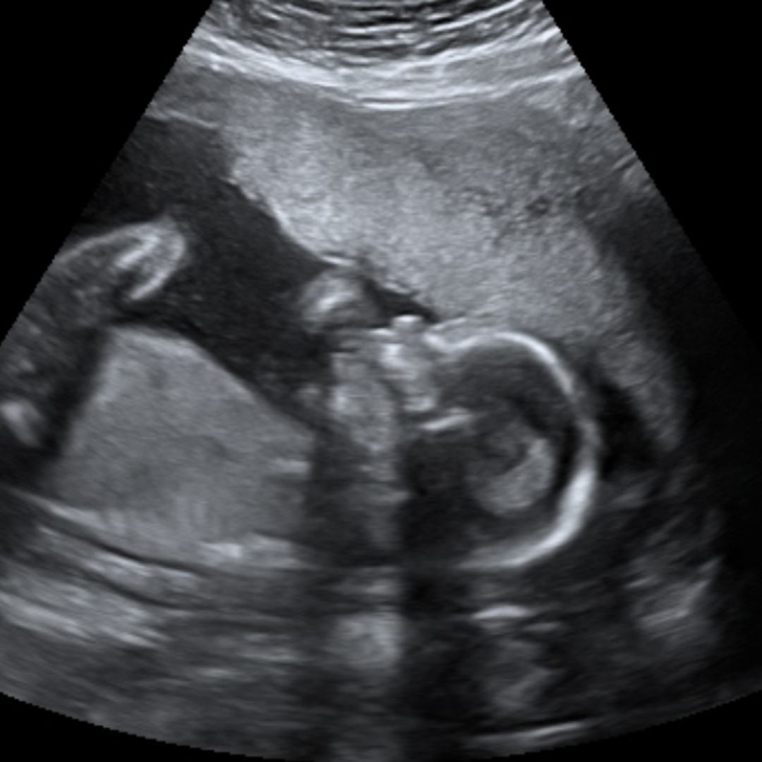 Photo shared by Ariane for their Babylist baby registry.