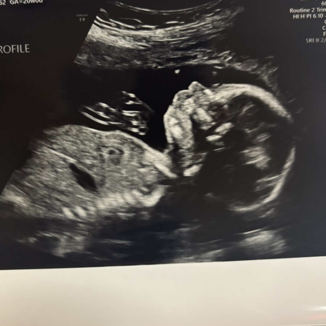 Photo shared by Chandler for their Babylist baby registry.