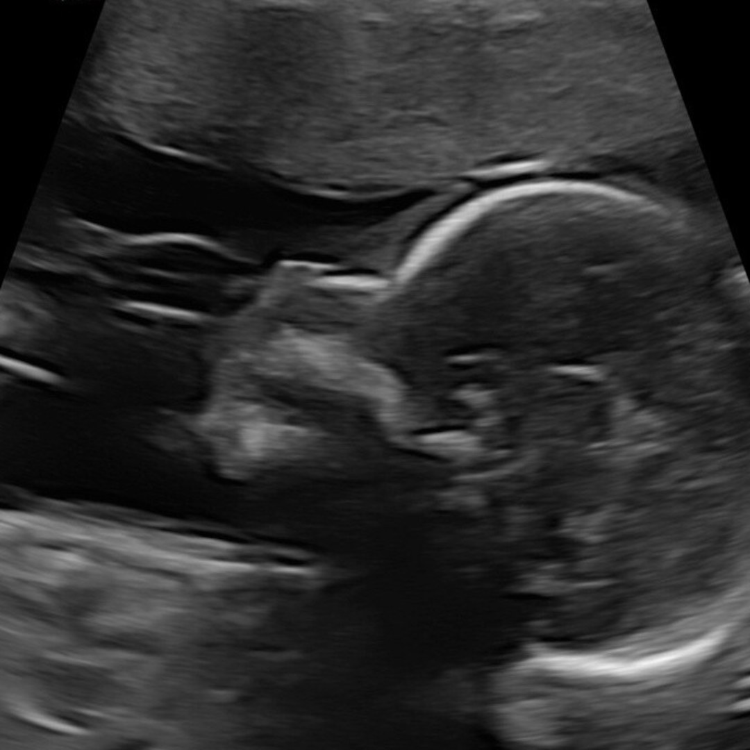 Photo shared by Kyrie for their Babylist baby registry.