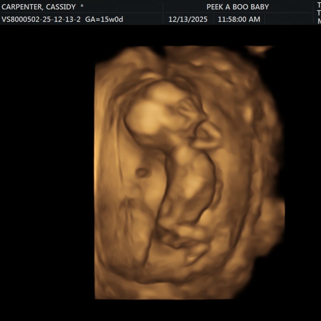 Photo shared by Cassidy for their Babylist baby registry.