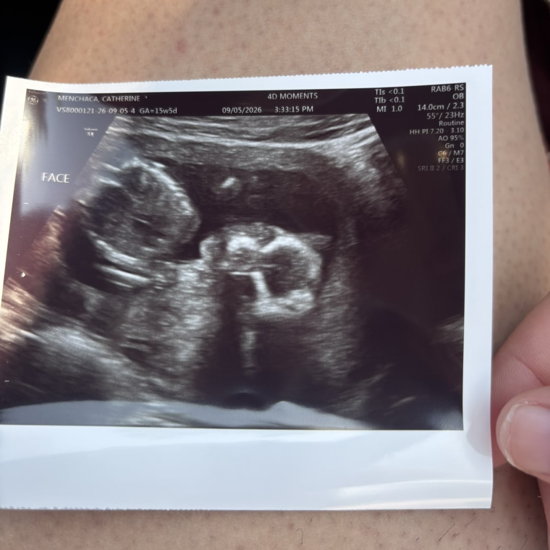 Photo shared by Catherine for their Babylist baby registry.