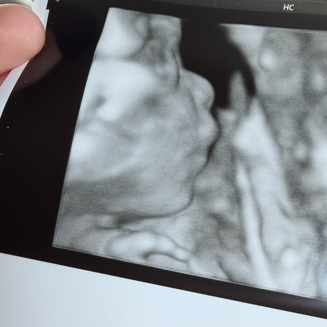 Photo shared by Taylor for their Babylist baby registry.