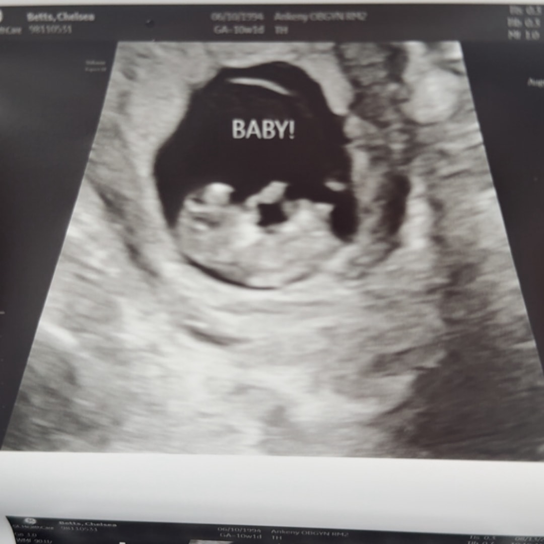 Photo shared by Chelsea for their Babylist baby registry.