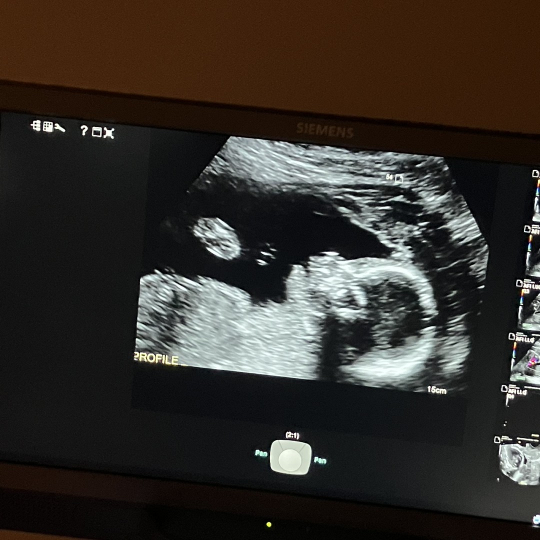 Photo shared by Cielo for their Babylist baby registry.