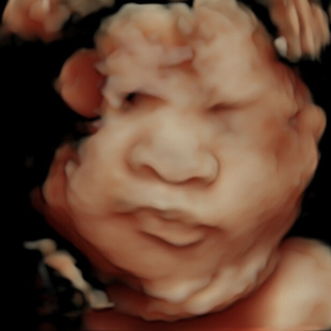 Photo shared by Caelin for their Babylist baby registry.