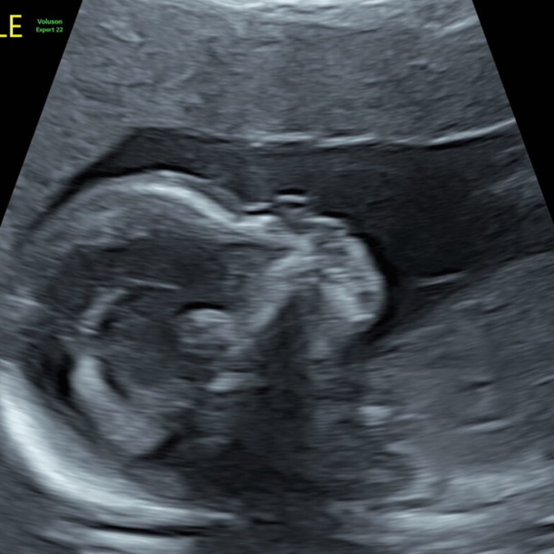 Photo shared by Brettianna for their Babylist baby registry.