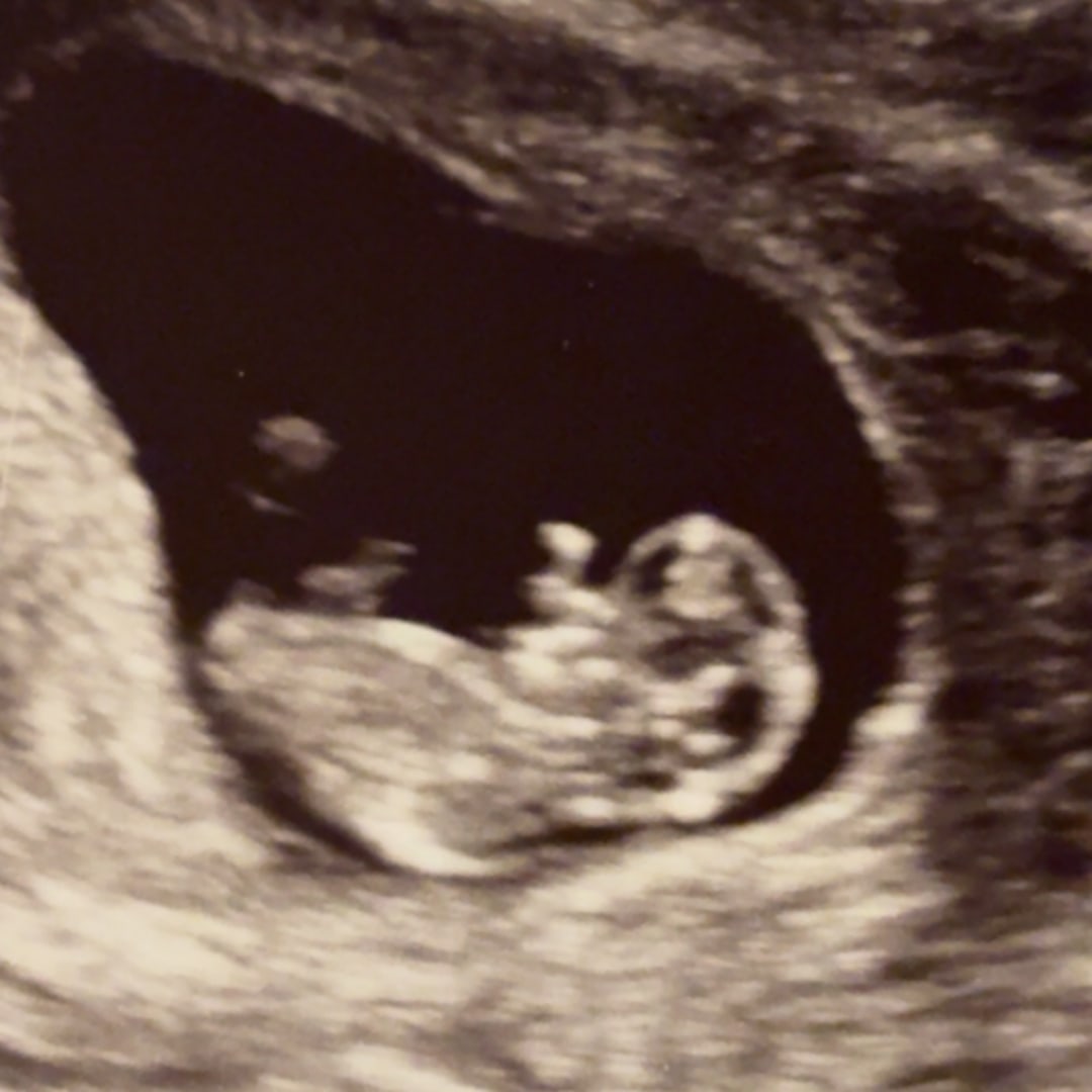 Photo shared by Chloe for their Babylist baby registry.