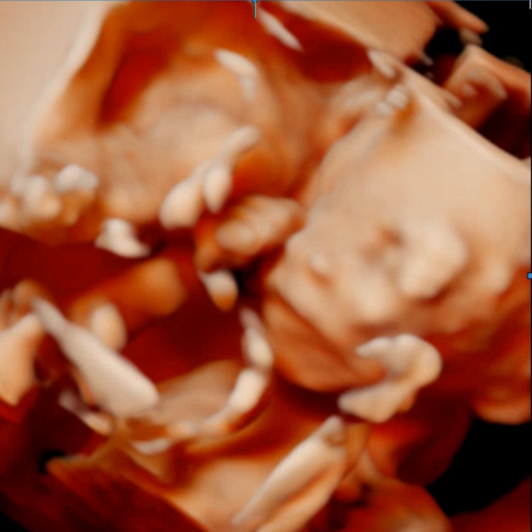 Photo shared by Bryanna for their Babylist baby registry.