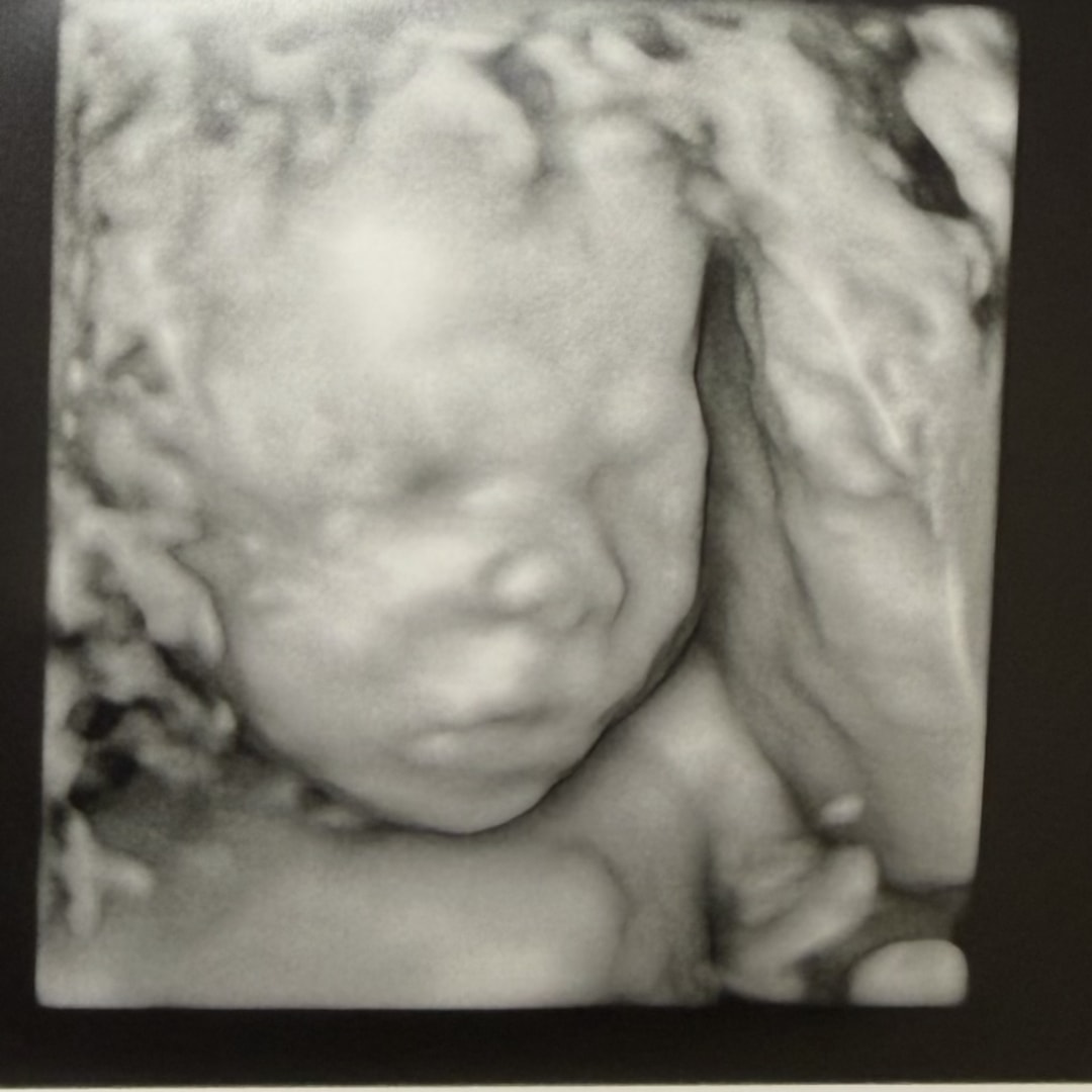 Photo shared by Chantelle for their Babylist baby registry.