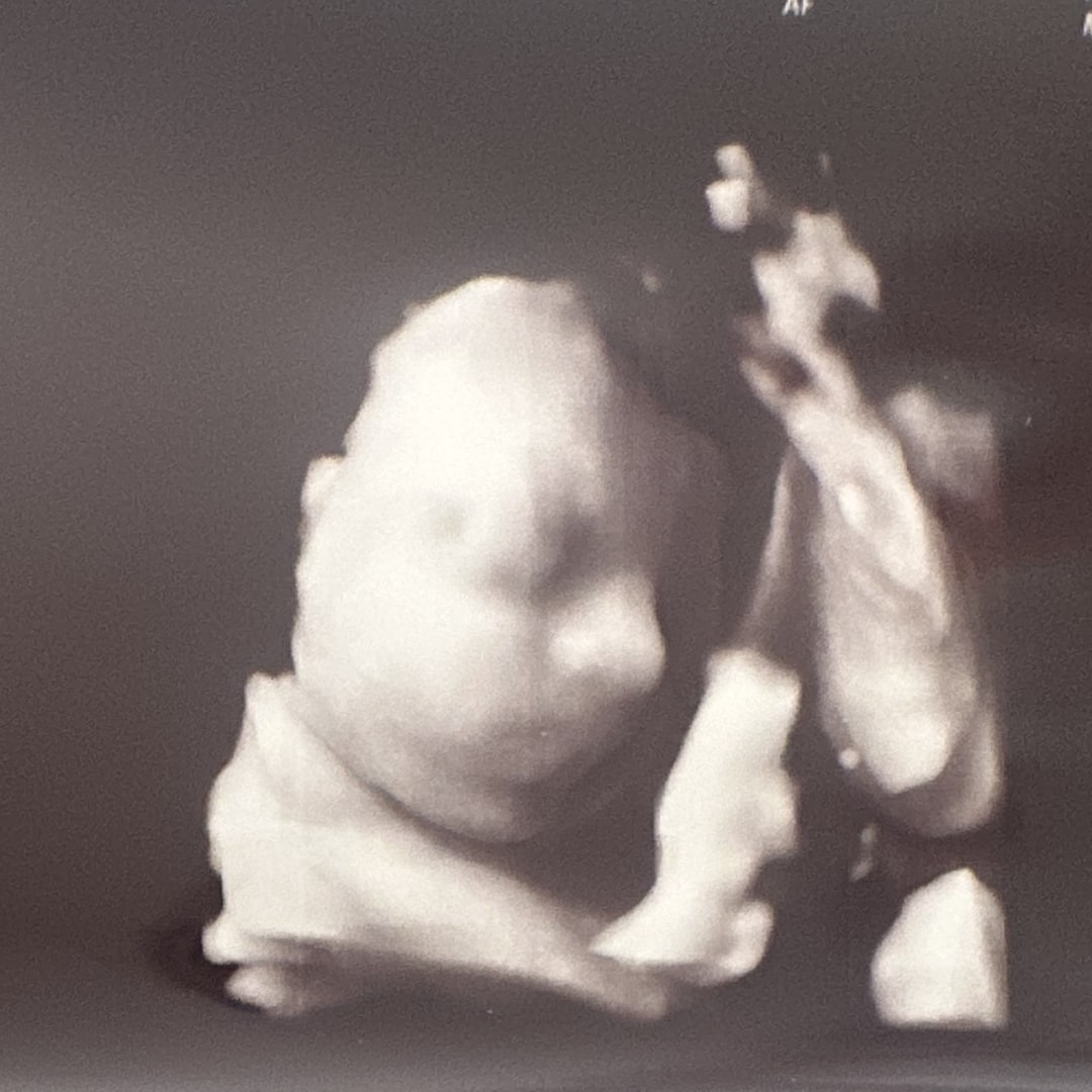 Photo shared by Rebecca for their Babylist baby registry.
