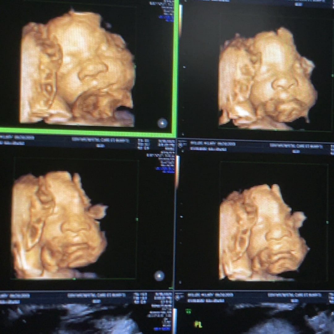 Photo shared by Hilary for their Babylist baby registry.