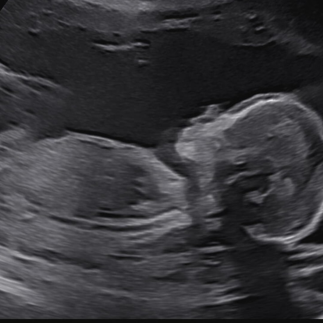 Photo shared by Lindsey for their Babylist baby registry.