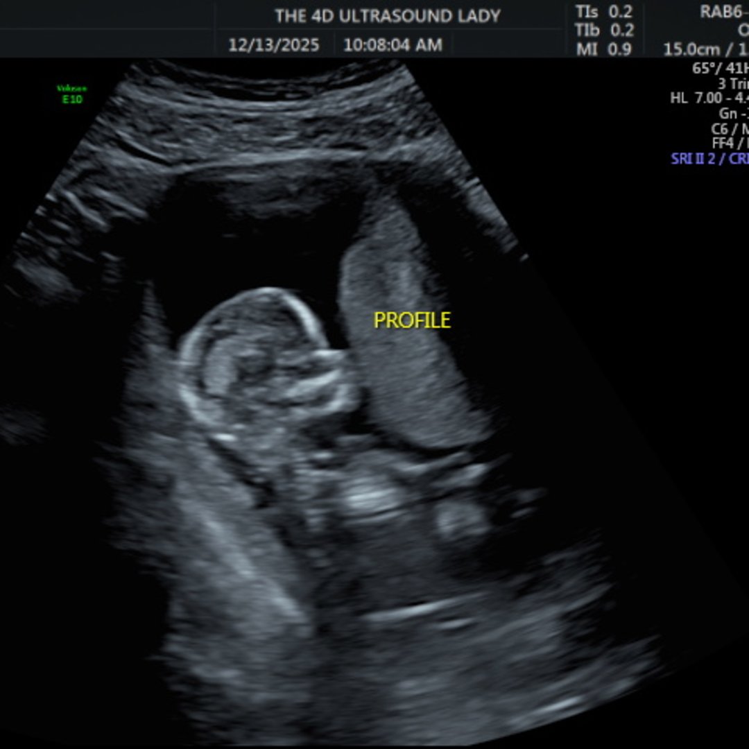 Photo shared by Kaysy for their Babylist baby registry.