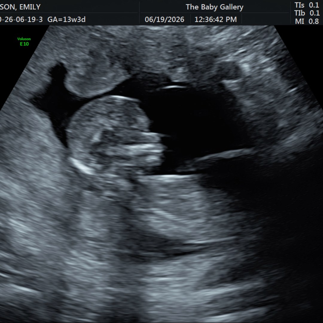Photo shared by Emily for their Babylist baby registry.