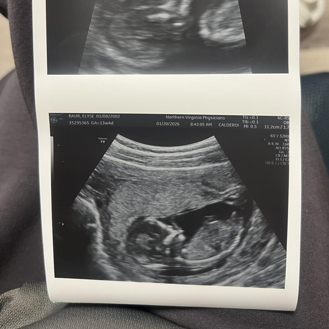 Photo shared by Elyse for their Babylist baby registry.