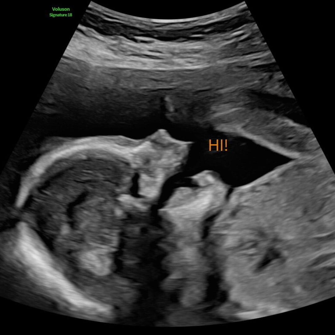 Photo shared by Emily for their Babylist baby registry.