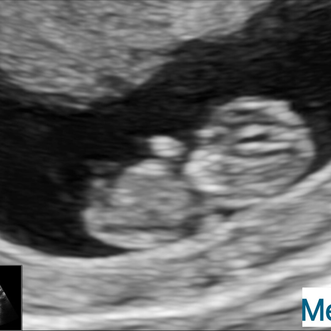 Photo shared by Ashley for their Babylist baby registry.