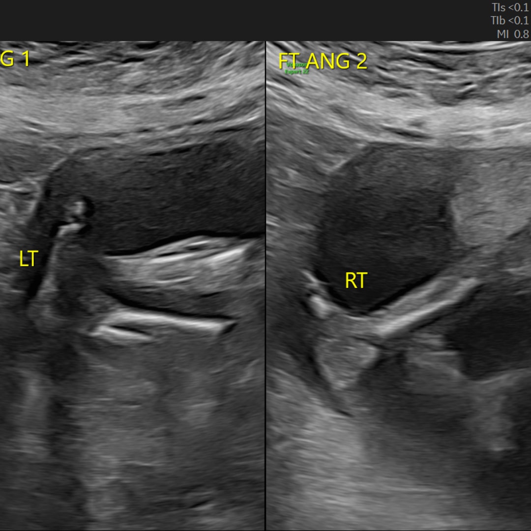 Photo shared by Ash for their Babylist baby registry.