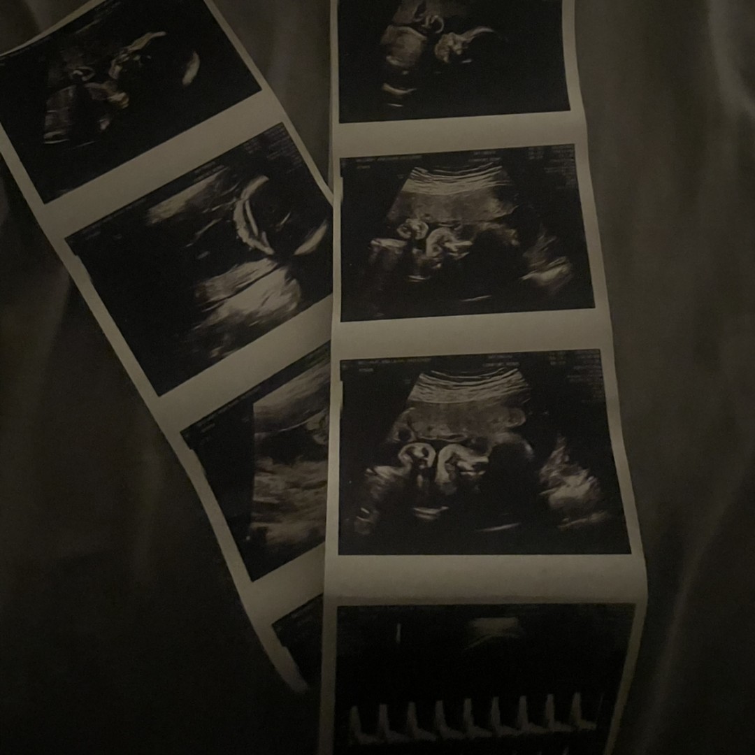 Photo shared by Analahya for their Babylist baby registry.