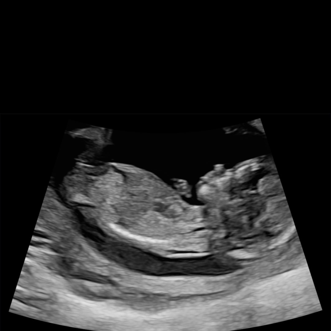 Photo shared by Lilee for their Babylist baby registry.