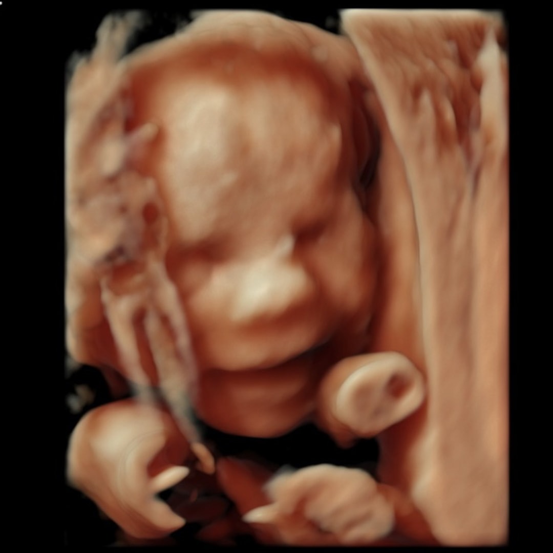 Photo shared by Grace for their Babylist baby registry.