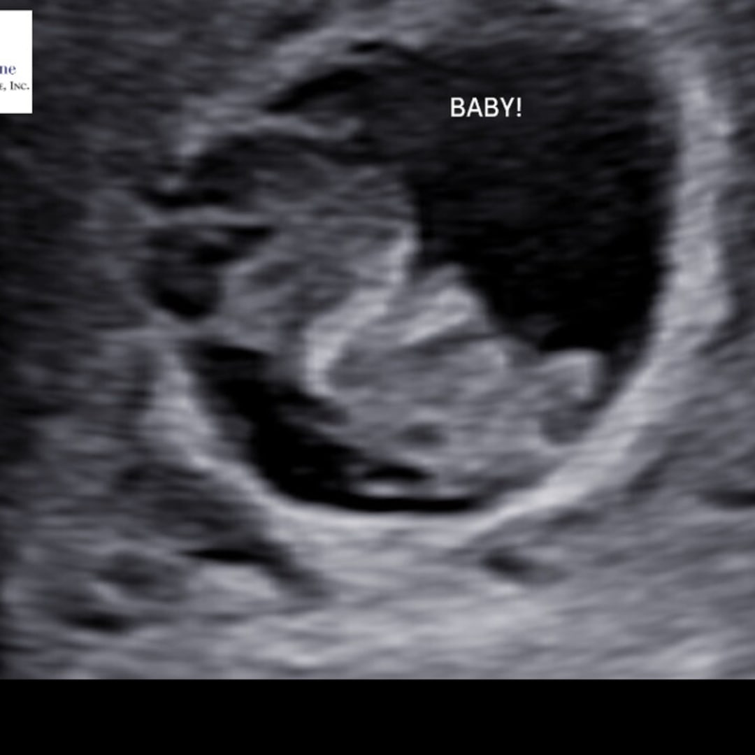 Photo shared by Ashlyn for their Babylist baby registry.