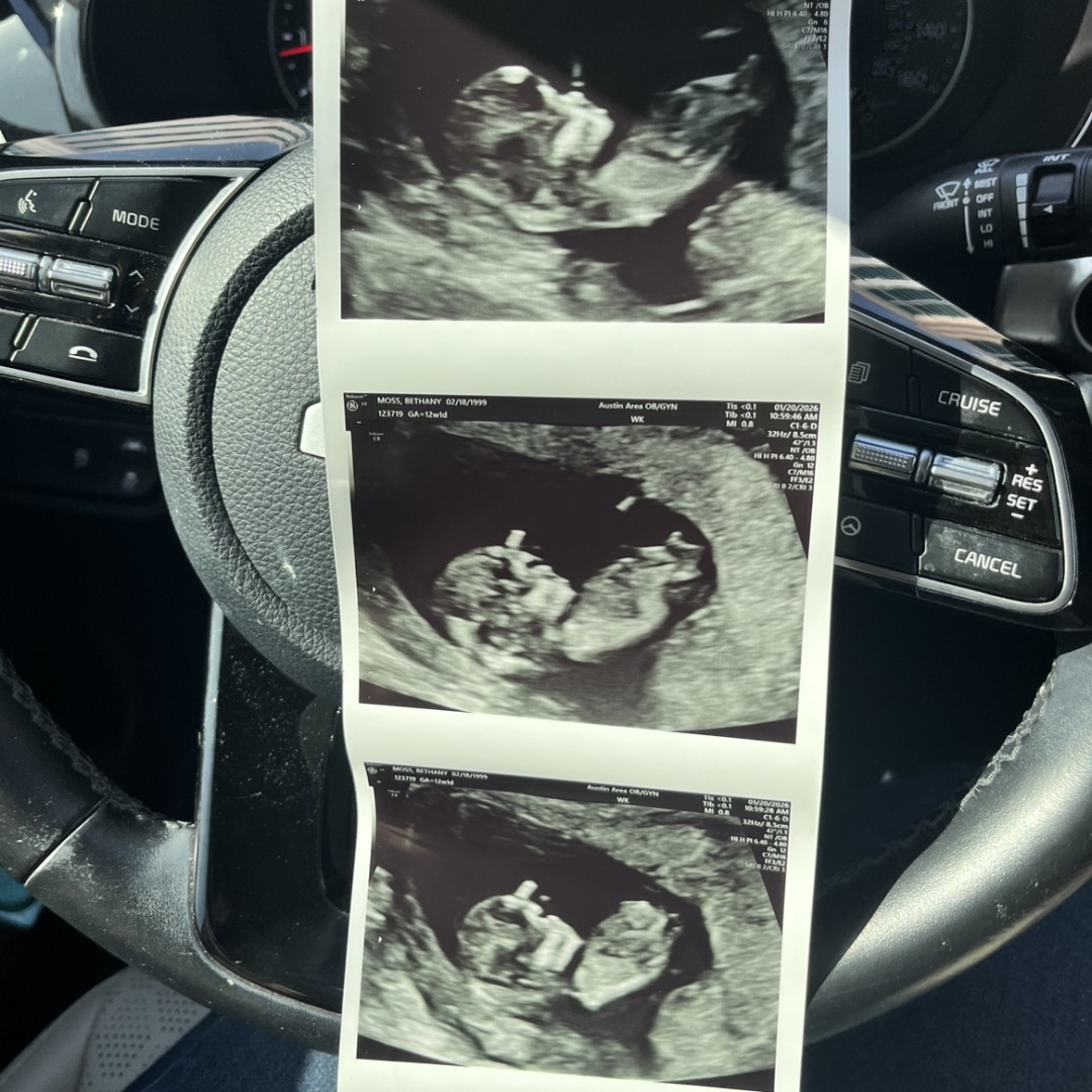 Photo shared by Bethany for their Babylist baby registry.