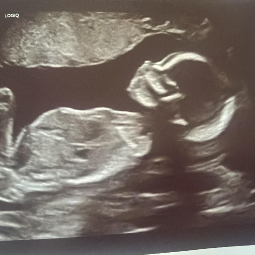 Photo shared by Emily for their Babylist baby registry.