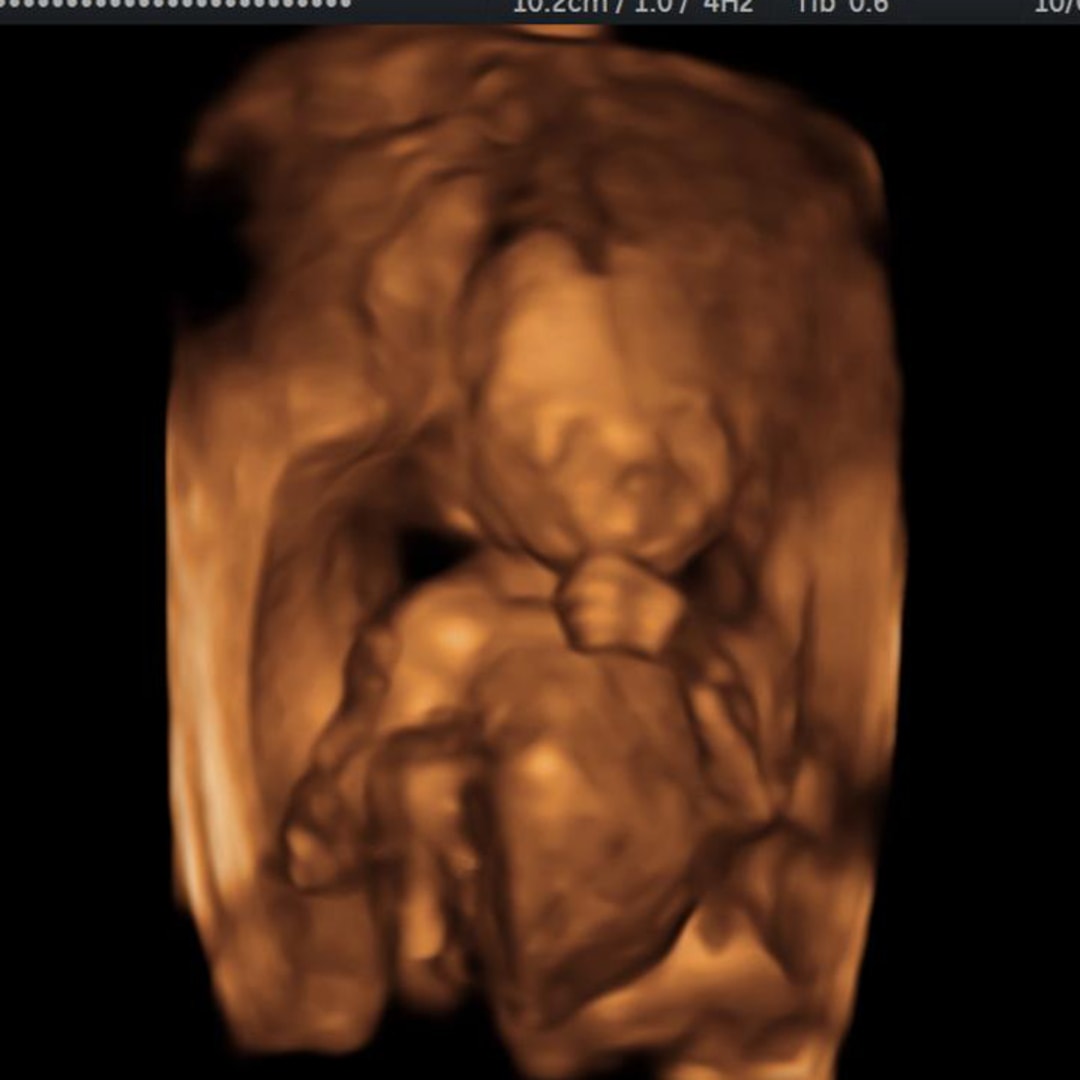 Photo shared by Mallory for their Babylist baby registry.