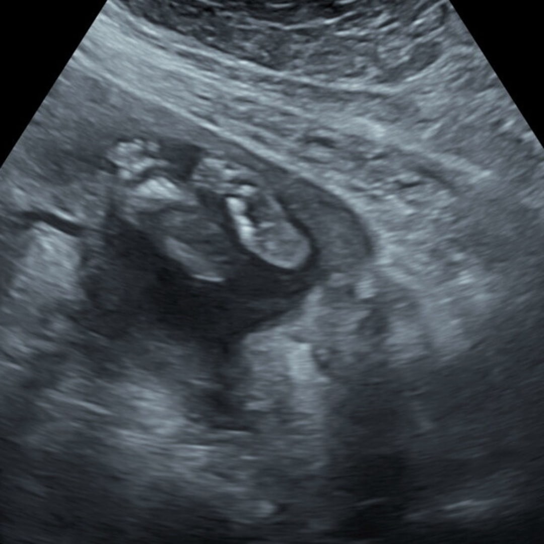 Photo shared by McKenna for their Babylist baby registry.