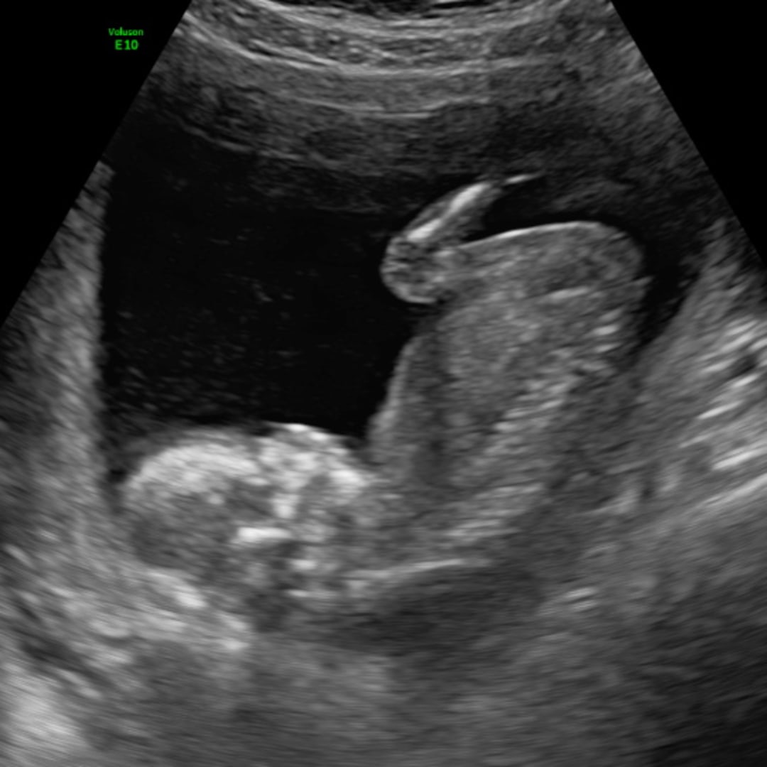 Photo shared by Alexis for their Babylist baby registry.