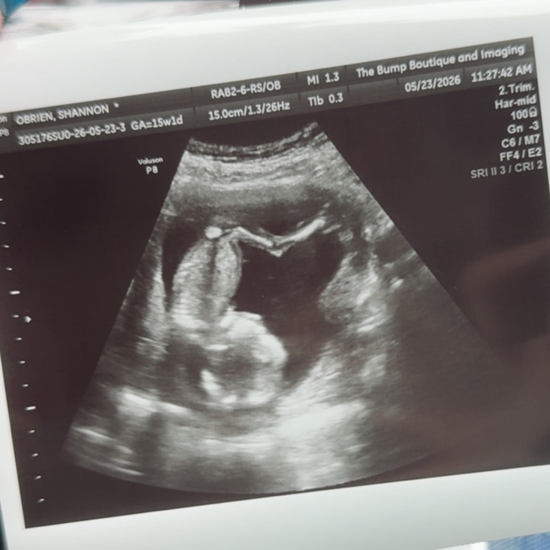 Photo shared by Shannon for their Babylist baby registry.