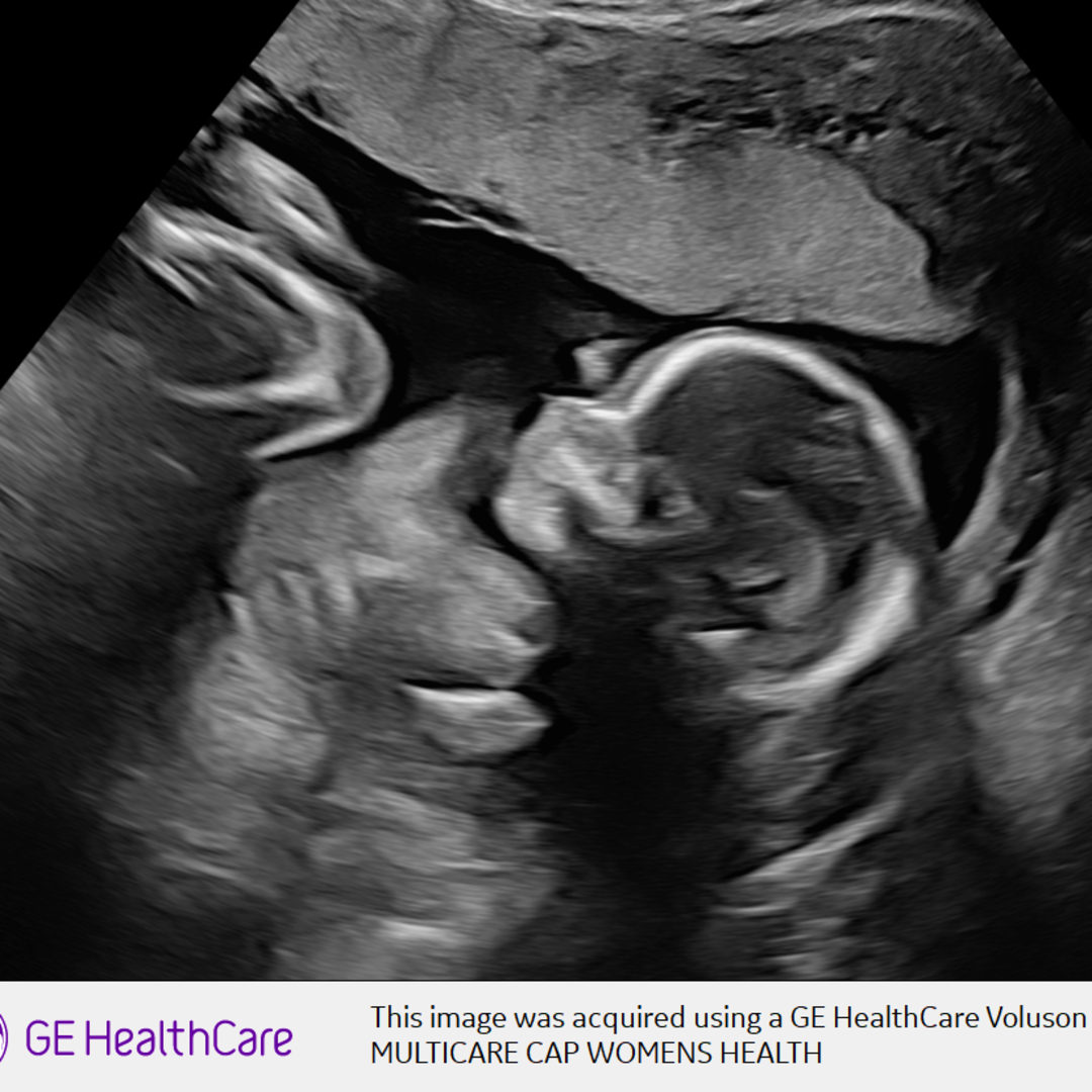 Photo shared by Sadie for their Babylist baby registry.