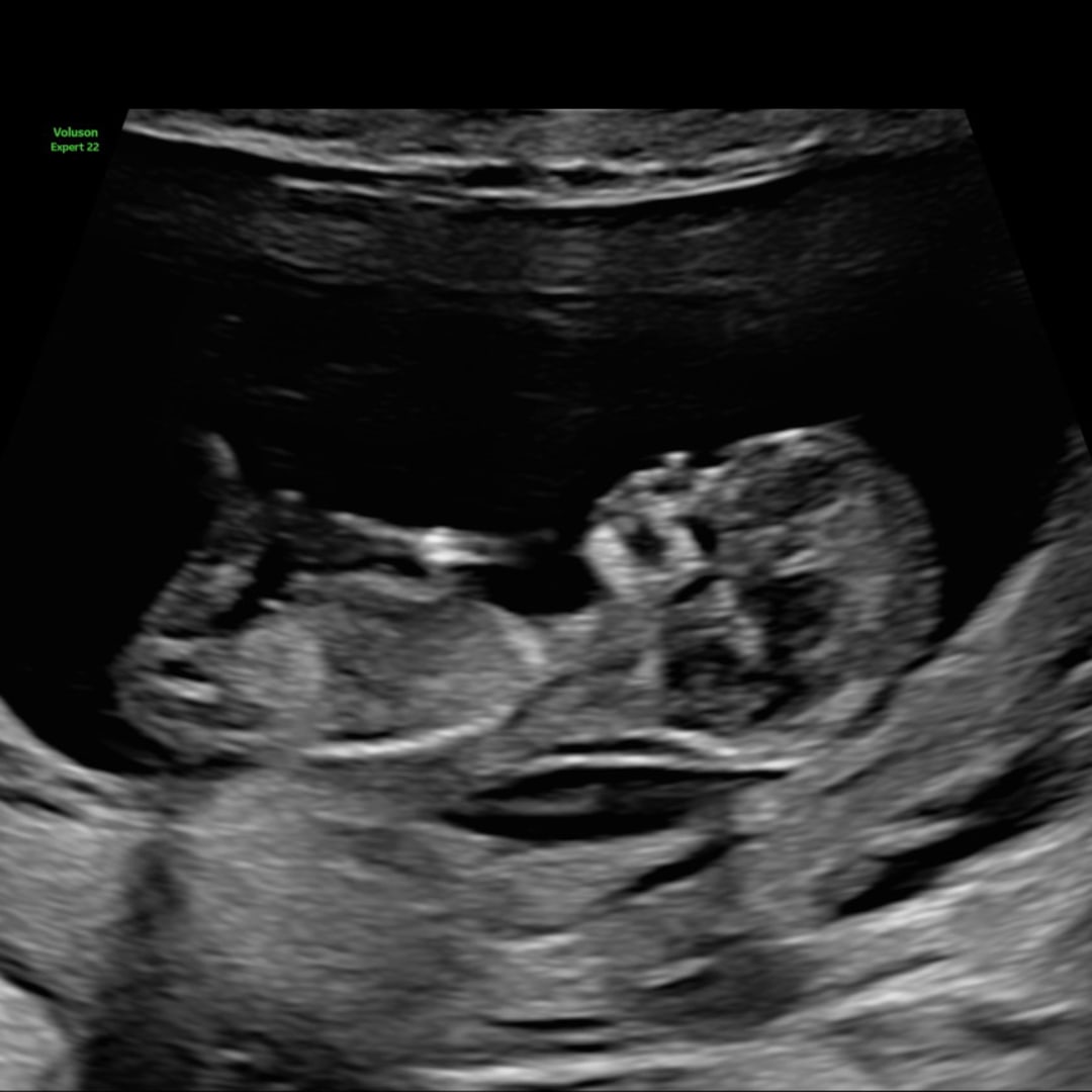 Photo shared by Brianna for their Babylist baby registry.