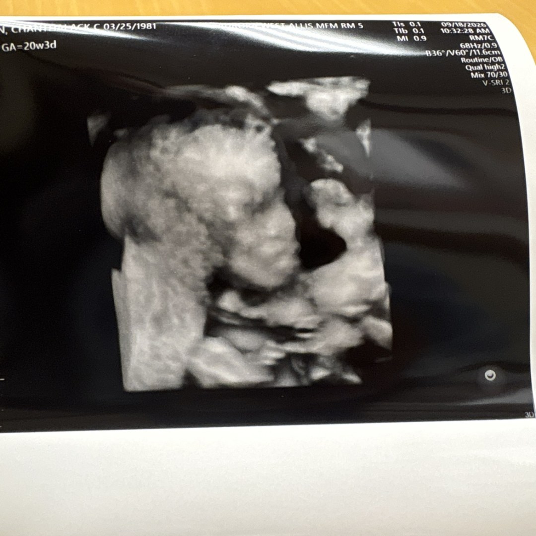 Photo shared by Connie for their Babylist baby registry.