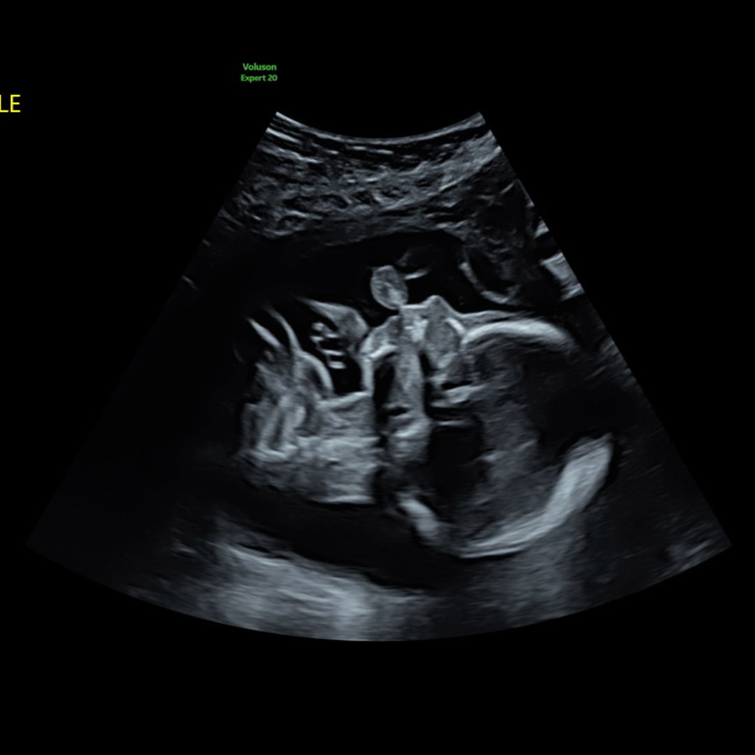 Photo shared by Lilli for their Babylist baby registry.