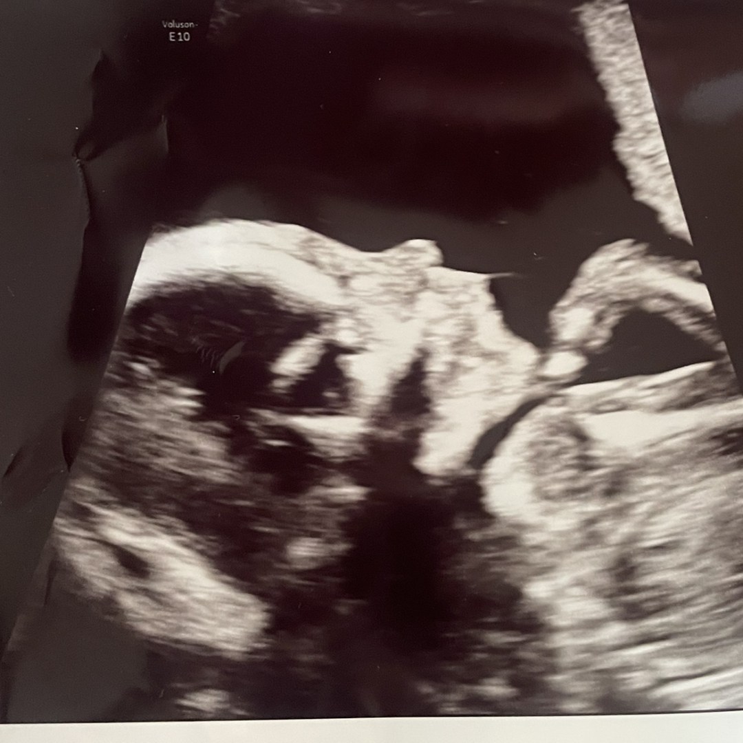 Photo shared by Becca for their Babylist baby registry.