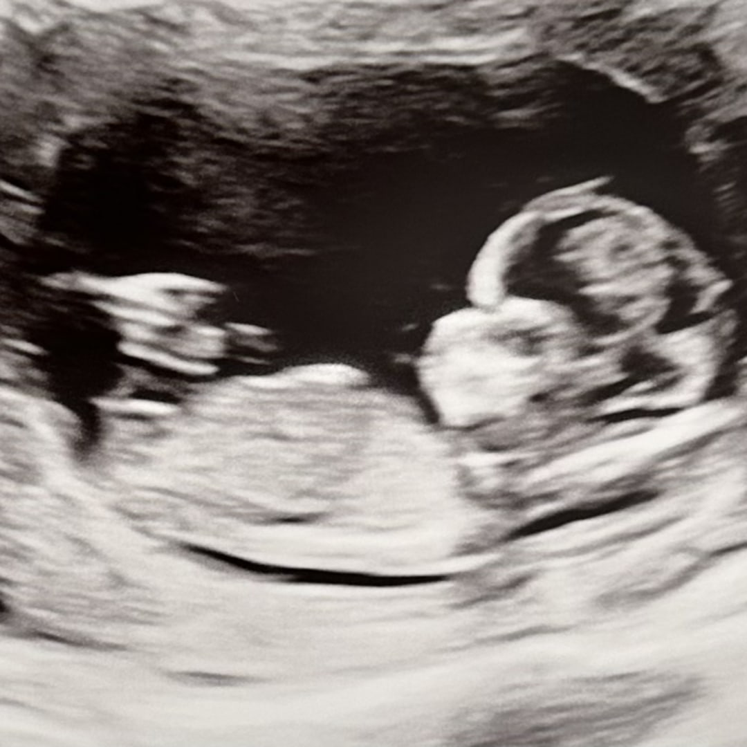 Photo shared by Amparo for their Babylist baby registry.