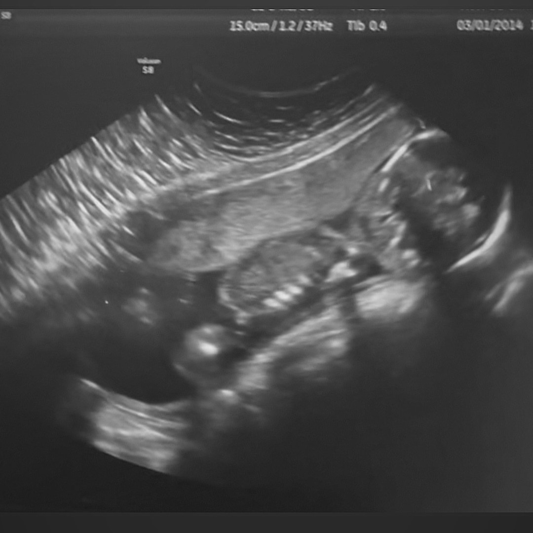 Photo shared by Destiny for their Babylist baby registry.