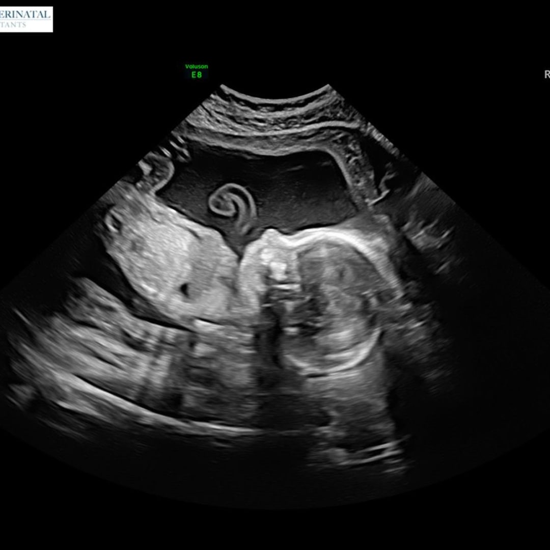 Photo shared by Annalise for their Babylist baby registry.