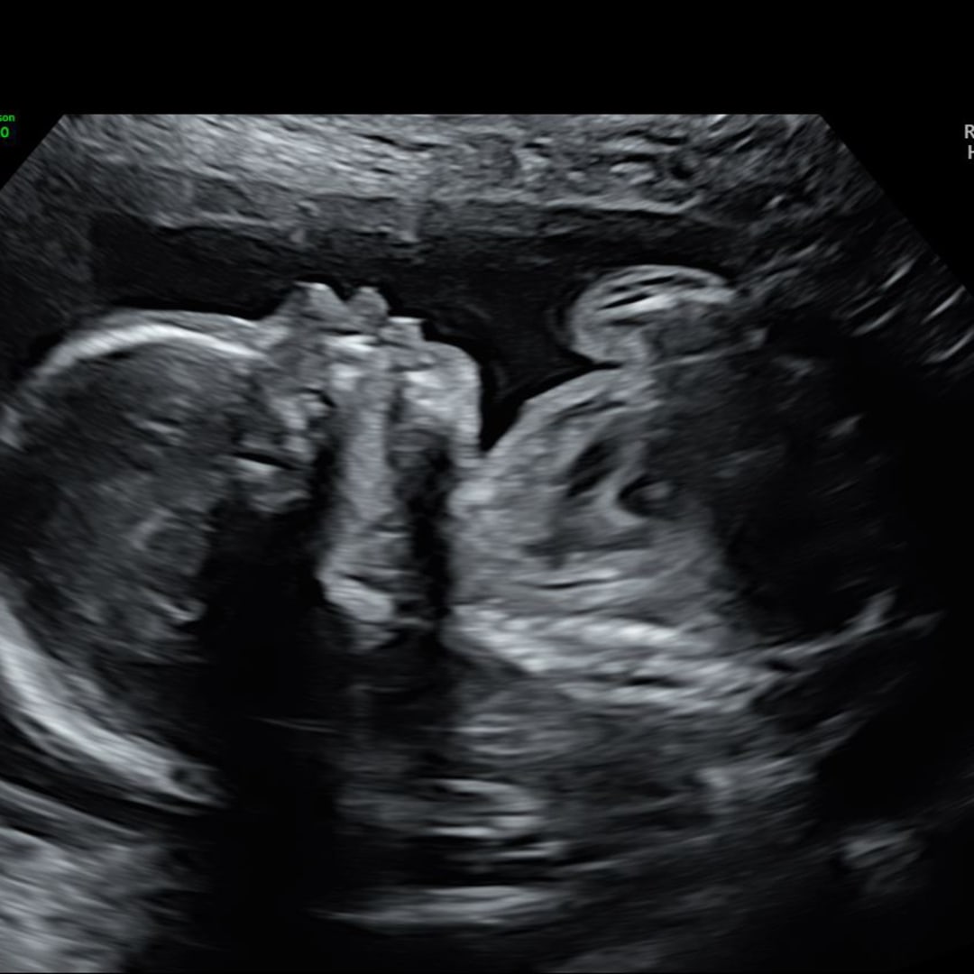 Photo shared by Jordan for their Babylist baby registry.