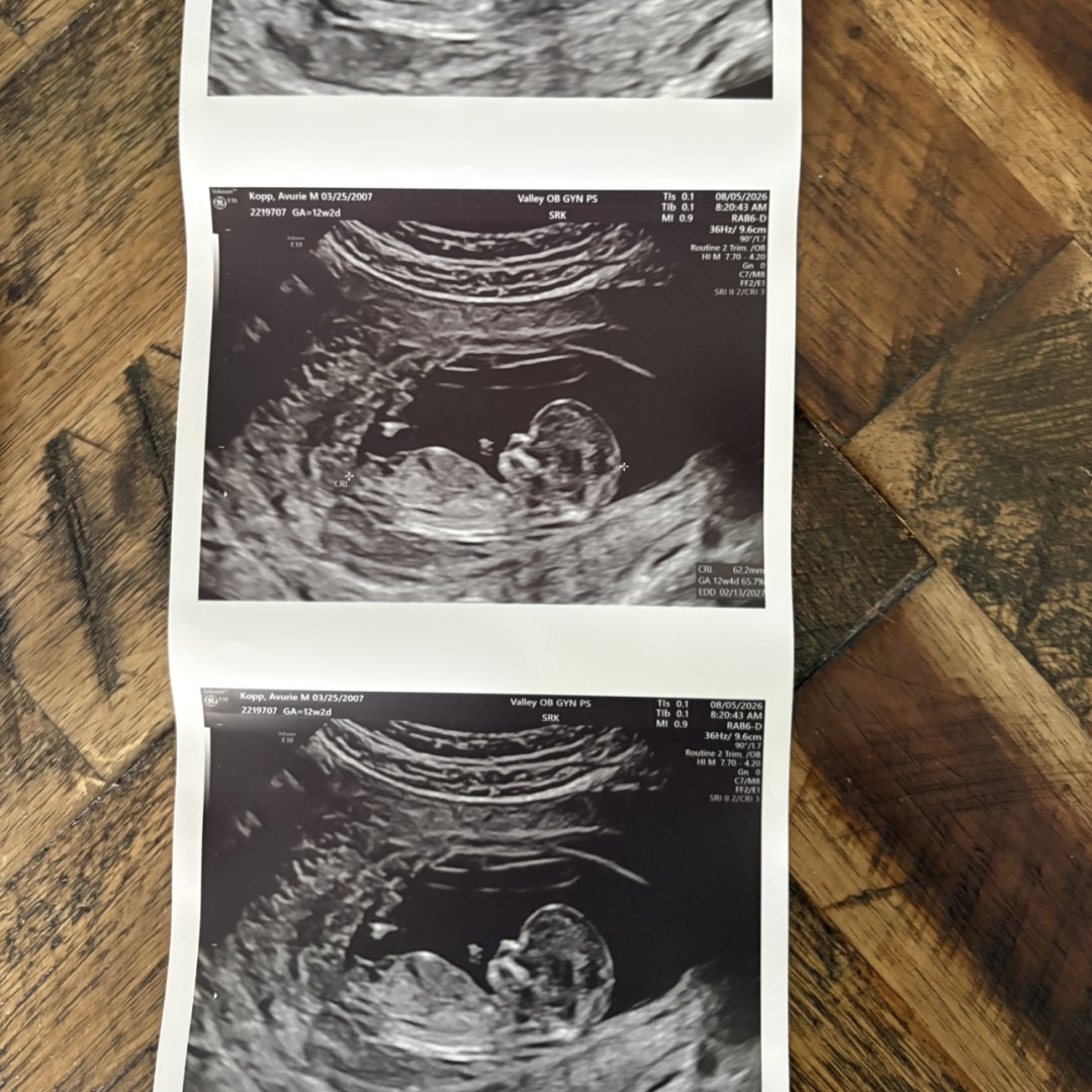 Photo shared by Avurie for their Babylist baby registry.