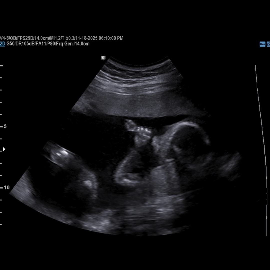 Photo shared by Christiana for their Babylist baby registry.