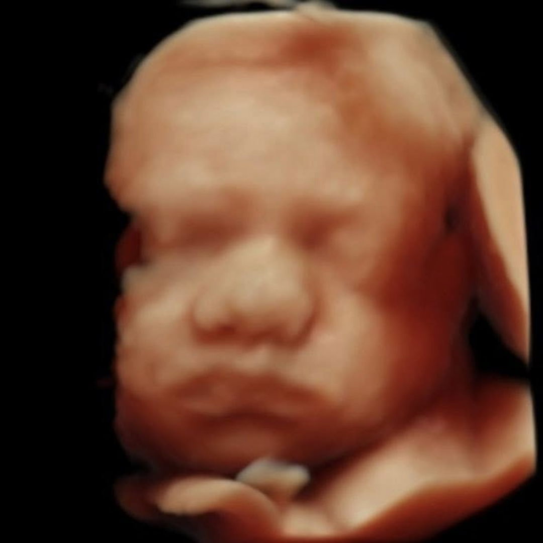 Photo shared by Koryn for their Babylist baby registry.