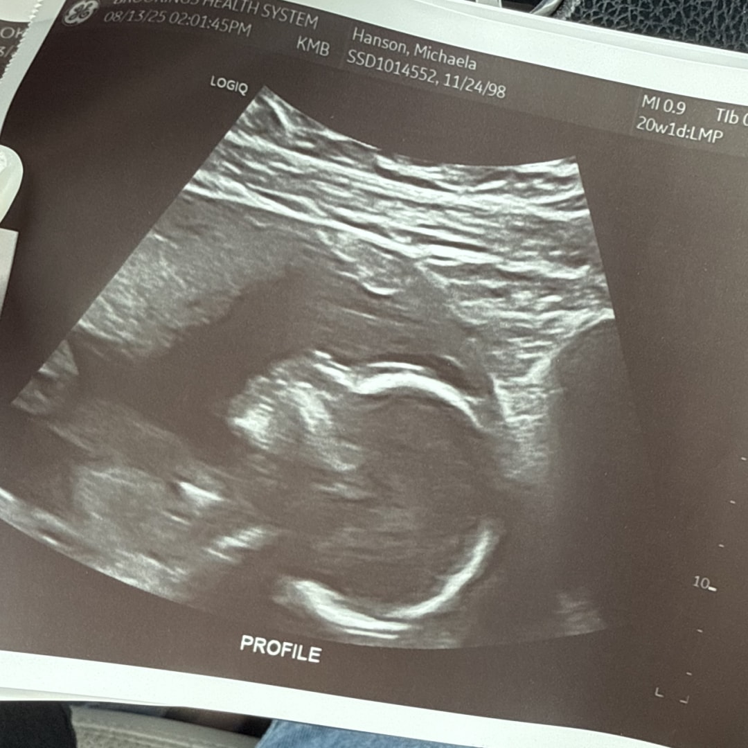 Photo shared by Michaela for their Babylist baby registry.