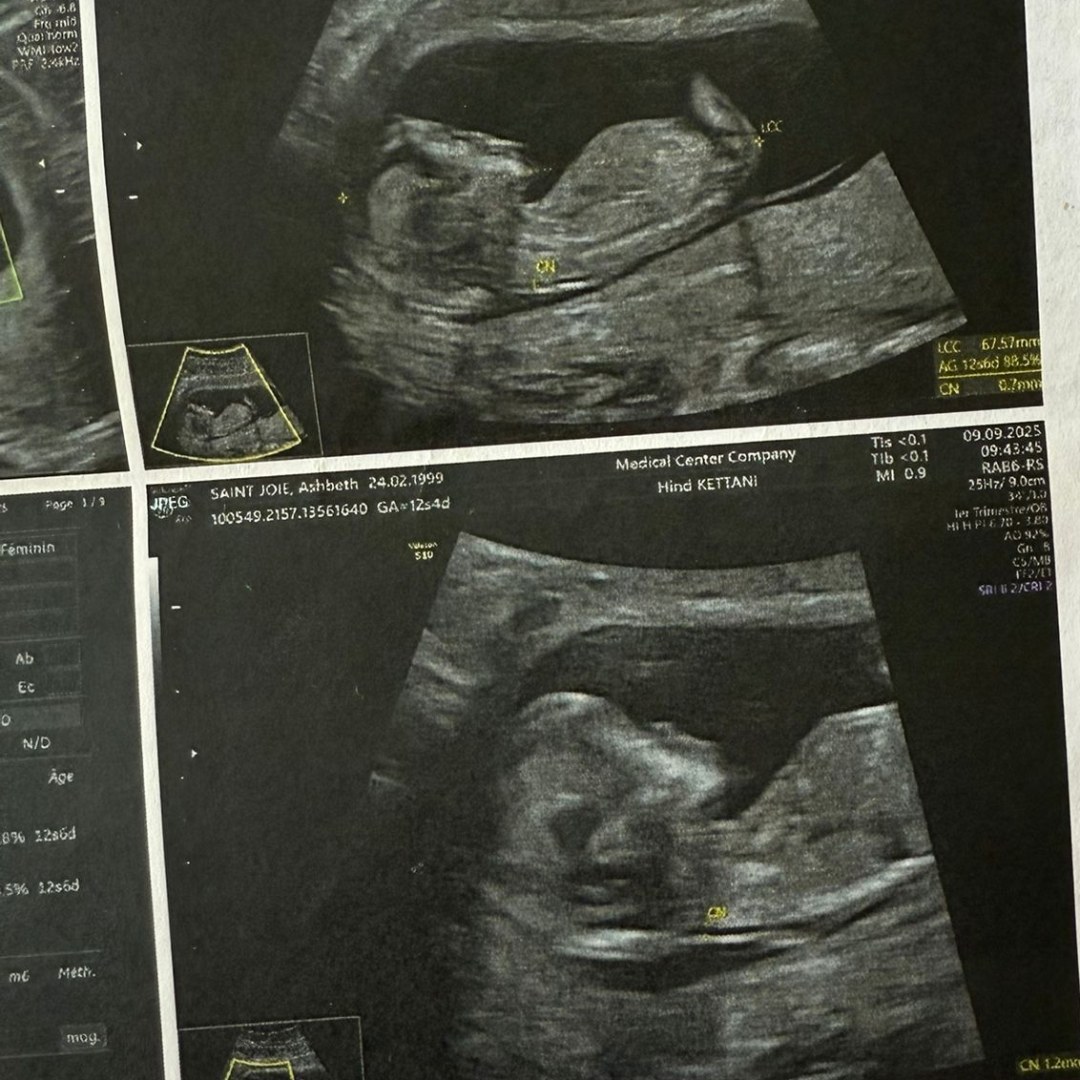 Photo shared by Ashbeth for their Babylist baby registry.