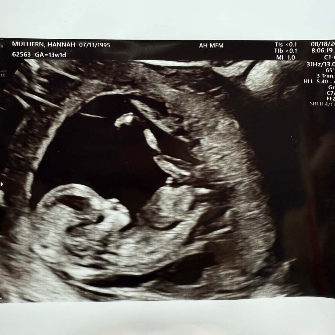 Photo shared by Hannah for their Babylist baby registry.